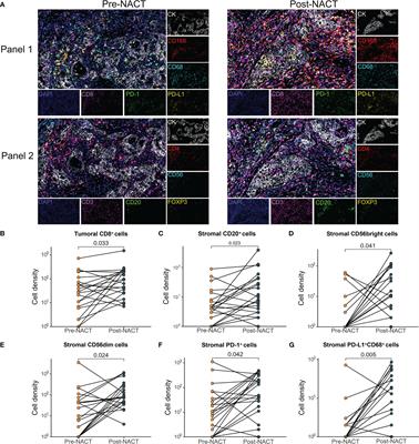 Tumor immune microenvironment changes are associated with response to neoadjuvant chemotherapy and long-term survival benefits in advanced epithelial ovarian cancer: A pilot study